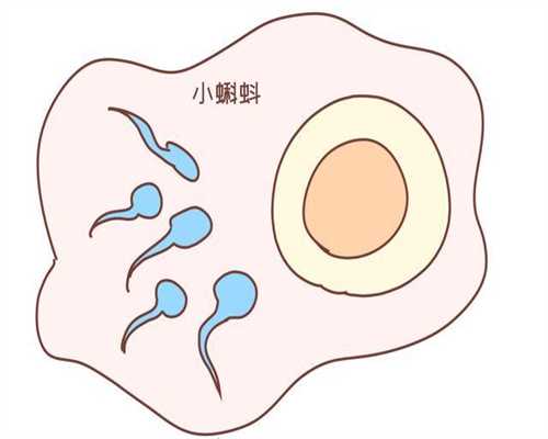 代孕网-试管婴儿代孕价格-代孕2月流一点褐色什么原因造成的